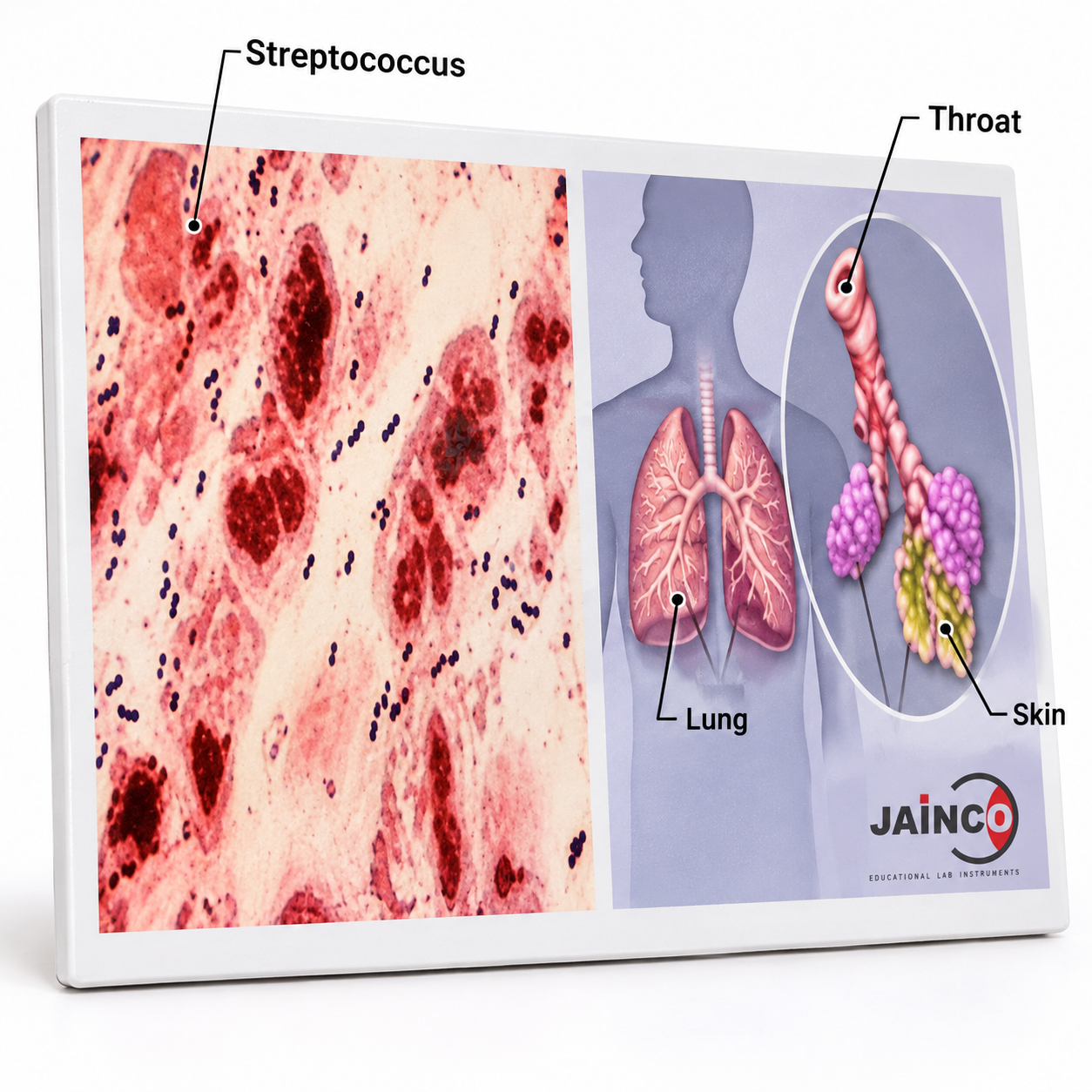 Streptococcus Species and Disease Model